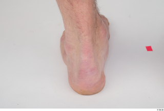 Turgen foot nude 0002.jpg